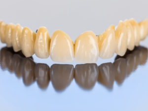 Close-up of a dental bridge showcasing natural-looking tooth replacements