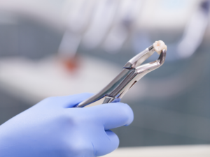 Dr. Sarah LeClere of East Indy Dental Care holding an extracted tooth with dental forceps