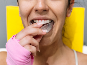 Patient fitting a custom mouth guard for teeth protection